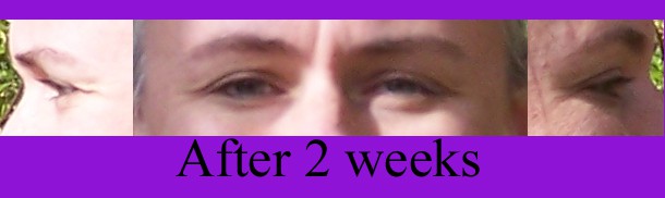 multi corrective eye opening serum