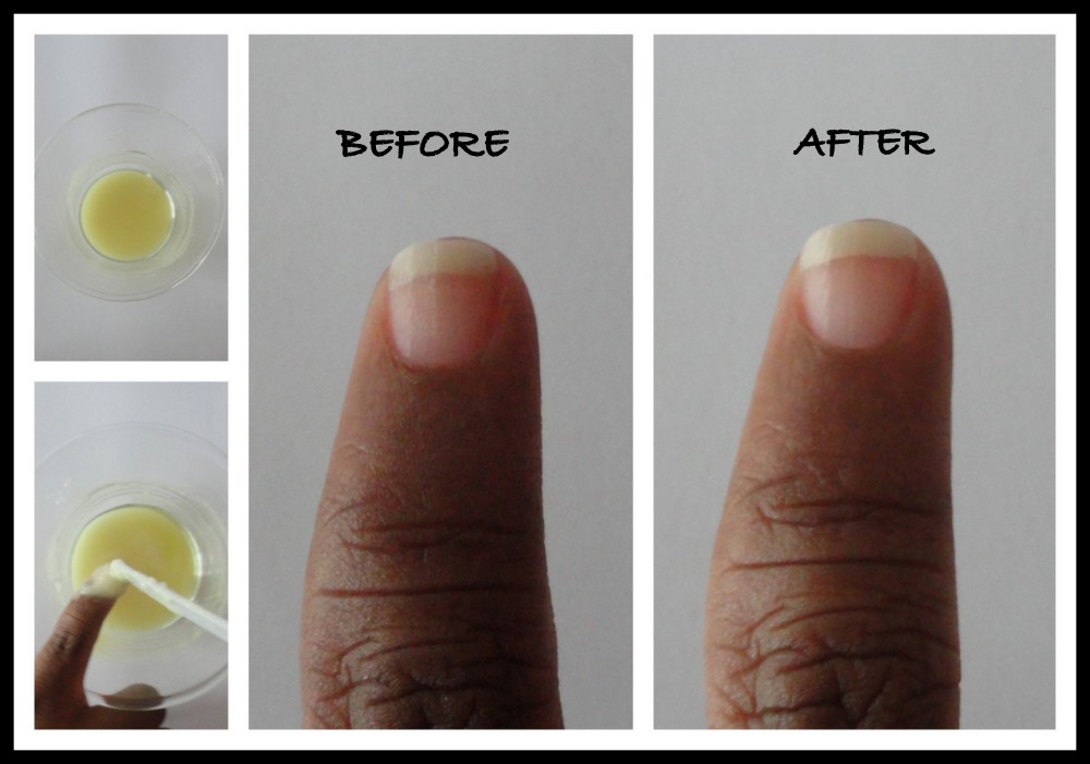 DIY Nail Care Whitener | Brand Advisor DIY Nail Care Whitener | Brand Advisor